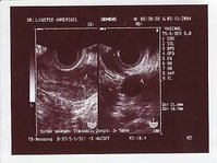 Ultraschall2.jpg