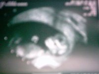 C:\Dokumente und Einstellungen\Smogli\Eigene Dateien\Eigene Bilder\baby2005\baby2005 003.jpg