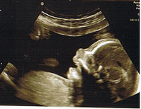 Baby Gesicht 2D.jpg