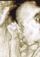Baby Gesicht-Hand 3D.jpg