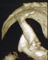 Beine-hand.jpg