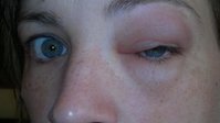 auge.jpg