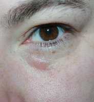 Auge 002.jpg
