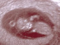 Baby.jpg