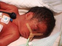 Three days old.JPG