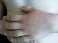 felixhand.JPG