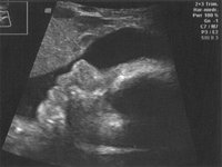 Ultraschall2-04.06..jpg