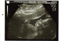 baby  KH Juli.jpg