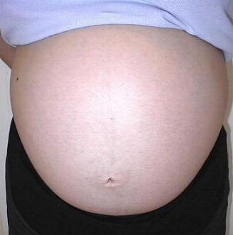 Bauch_040707_vorne.jpg
