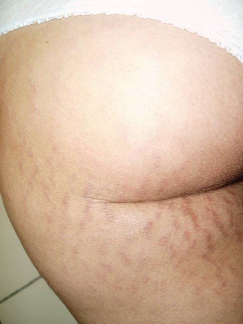 P1010031.JPG