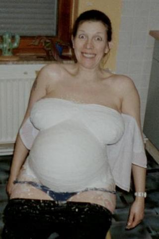 Gipsbauch4.jpg