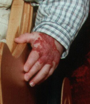 blut4m.jpg